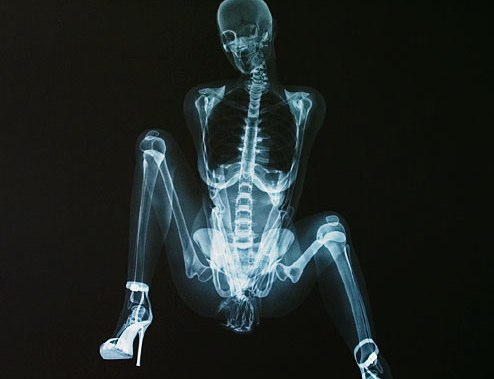 X-Rated X-Ray Pin Up Calendar Pictures - CBS News.jpg